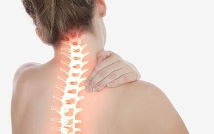 Como osteocondrose da coluna cervical se manifesta
