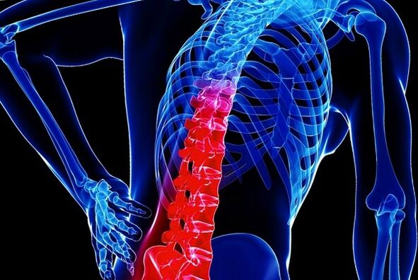As razões para o desenvolvimento da osteocondrose torácica
