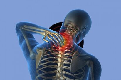 dor no pescoço com osteocondrose