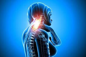 osteocondrose na coluna cervical